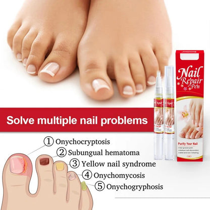 Nail Repair Pen Easy Repair